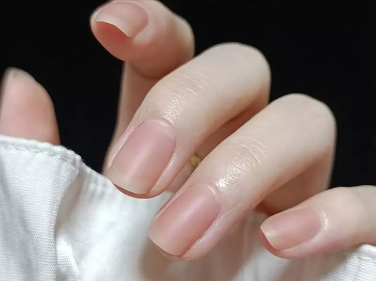 BMH Beauty 寶豫美容養生中心 趾甲矯形及灰甲處理